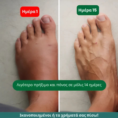 Zenstride® Αναπνεύσιμες κάλτσες συμπίεσης για πόδια και πέλματα χωρίς πόνο