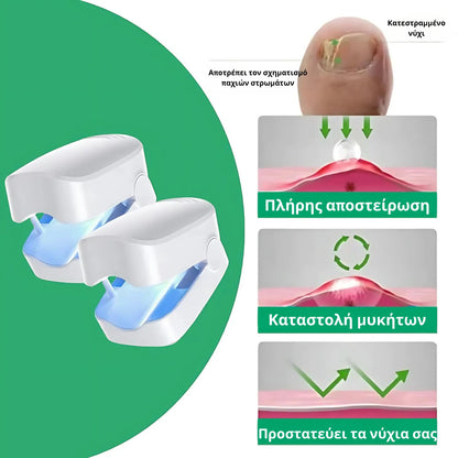 Varnexil™ - Εξαλείψτε οριστικά τους μύκητες των νυχιών, ακόμα και τους πιο επίμονους